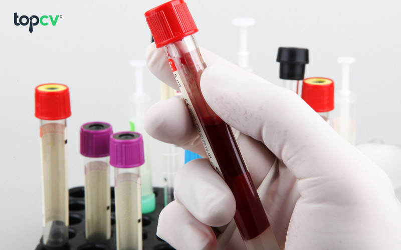 Khám phá thông tin chi tiết về chương trình du học nghề Đức ngành Điều dưỡng