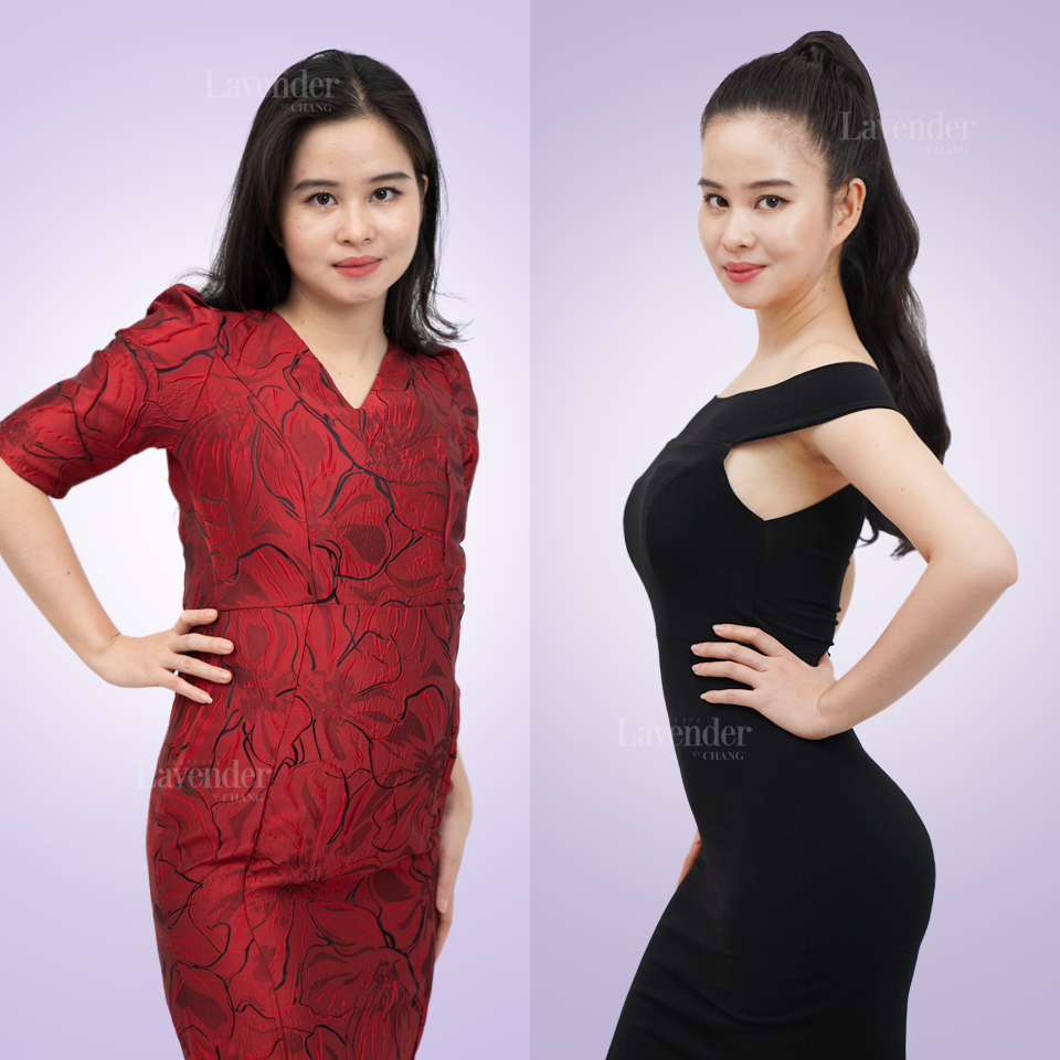 Dịch vụ giảm béo